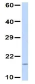 Anti-UBE2D3 antibody, N-term used in Western Blot (WB). GTX46939