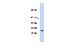 Anti-HERC4 antibody, N-term used in Western Blot (WB). GTX46941