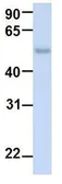 Anti-TJAP1 antibody, N-term used in Western Blot (WB). GTX46946