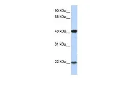 Anti-LIN7C antibody, Internal used in Western Blot (WB). GTX46949