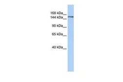 Anti-Symplekin antibody, N-term used in Western Blot (WB). GTX46952