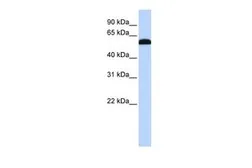 Anti-ZGPAT antibody, Internal used in Western Blot (WB). GTX46963