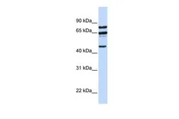 Anti-PPP4R2 antibody, C-term used in Western Blot (WB). GTX46965
