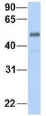 Anti-ZGPAT antibody, C-term used in Western Blot (WB). GTX46974