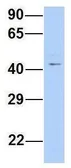 Anti-TRABD antibody, Internal used in Western Blot (WB). GTX46982