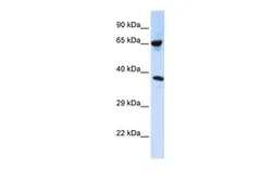 Anti-C6ORF134 antibody, Internal used in Western Blot (WB). GTX46984