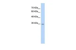 Anti-C6ORF134 antibody, N-term used in Western Blot (WB). GTX46985