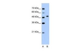 Anti-Protor-2 antibody, N-term used in Western Blot (WB). GTX46988