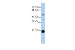 Anti-ZDHHC14 antibody, N-term used in Western Blot (WB). GTX46989