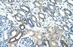 Anti-PSG3 antibody, N-term used in IHC (Paraffin sections) (IHC-P). GTX46992
