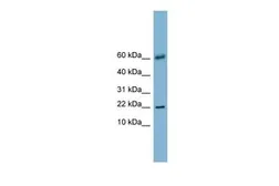 Anti-LGALS14 antibody, N-term used in Western Blot (WB). GTX46996