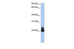 Anti-RHOD antibody, N-term used in Western Blot (WB). GTX47031