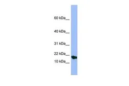 Anti-SMR3A antibody, Internal used in Western Blot (WB). GTX47040