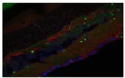 Anti-SLC38A3 antibody, N-term used in Immunohistochemistry (IHC). GTX47047