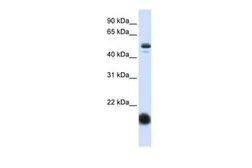Anti-SLC22A7 antibody, N-term used in Western Blot (WB). GTX47048