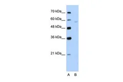 Anti-SLC22A7 antibody, N-term used in Western Blot (WB). GTX47049