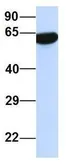 Anti-PRSS16 antibody, Internal used in Western Blot (WB). GTX47053