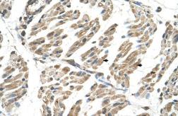 Anti-SLC6A8 antibody, N-term used in IHC (Paraffin sections) (IHC-P). GTX47057