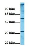 Anti-SLC1A5 antibody, Internal used in Western Blot (WB). GTX47058