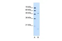 Anti-ITGBL1 antibody, N-term used in Western Blot (WB). GTX47065