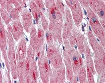 Anti-DMPK antibody, Internal used in IHC (Paraffin sections) (IHC-P). GTX47067