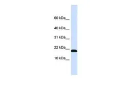 Anti-DNAJC25-GNG10 antibody, N-term used in Western Blot (WB). GTX47069