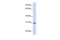 Anti-Stanniocalcin 1 antibody, N-term used in Western Blot (WB). GTX47080