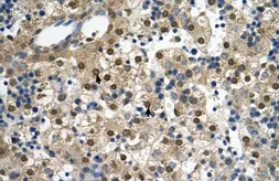 Anti-SQLE antibody, C-term used in IHC (Paraffin sections) (IHC-P). GTX47082