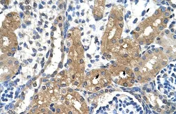 Anti-CYP4A22 antibody, N-term used in IHC (Paraffin sections) (IHC-P). GTX47105