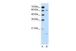 Anti-CYP4A22 antibody, N-term used in Western Blot (WB). GTX47105