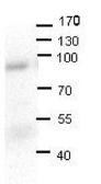 Anti-LSS antibody, N-term used in Western Blot (WB). GTX47109