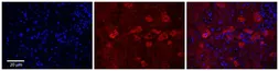 Anti-CYP4F3 antibody, N-term used in IHC (Paraffin sections) (IHC-P). GTX47110