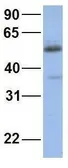 Anti-CYP2C19 antibody, Internal used in Western Blot (WB). GTX47113