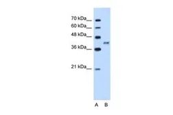 Anti-BDKRB2 antibody, N-term used in Western Blot (WB). GTX47119