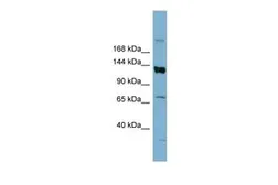 Anti-ABCB4 antibody, Internal used in Western Blot (WB). GTX47122