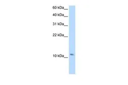 Anti-SMPX antibody, Internal used in Western Blot (WB). GTX47137