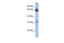 Anti-C11ORF54 antibody, N-term used in Western Blot (WB). GTX47139