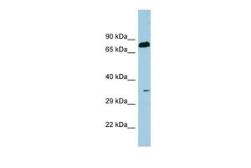 Anti-SDS antibody, N-term used in Western Blot (WB). GTX47143