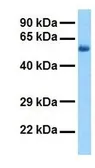 Anti-HMGCS2 antibody, N-term used in Western Blot (WB). GTX47146