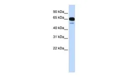 Anti-SLC22A8 antibody, Internal used in Western Blot (WB). GTX47149