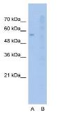Anti-SLC22A1 antibody, N-term used in Western Blot (WB). GTX47150
