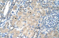 Anti-SLC13A3 antibody, Internal used in IHC (Paraffin sections) (IHC-P). GTX47155