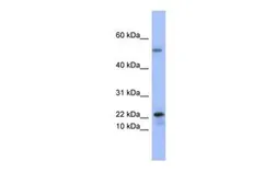 Anti-PLA2G5 antibody, Internal used in Western Blot (WB). GTX47160