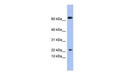 Anti-PLA2G5 antibody, N-term used in Western Blot (WB). GTX47161