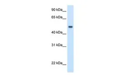 Anti-MAT1A antibody, C-term used in Western Blot (WB). GTX47162