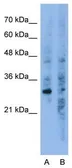 Anti-GNB1L antibody, C-term used in Western Blot (WB). GTX47168