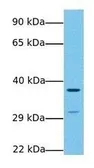 Anti-Wnt7b antibody, Internal used in Western Blot (WB). GTX47171