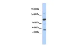 Anti-SR140 antibody, N-term used in Western Blot (WB). GTX47178