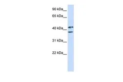 Anti-ZRANB2 antibody, Internal used in Western Blot (WB). GTX47181
