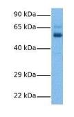 Anti-CPEB2 antibody, Internal used in Western Blot (WB). GTX47192